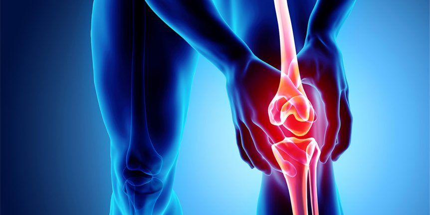 Managing Knee Osteoarthritis